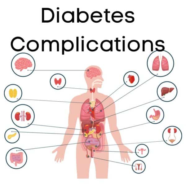 diabetes complications visual