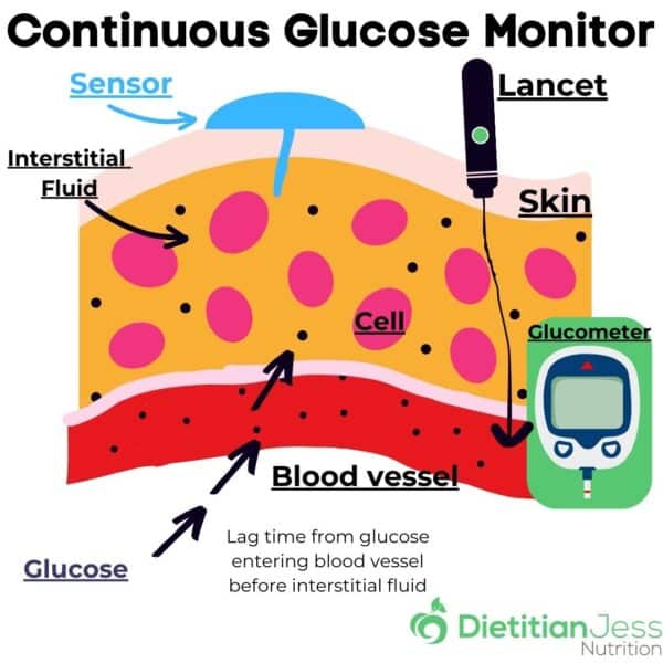 اندازه گیری CGM